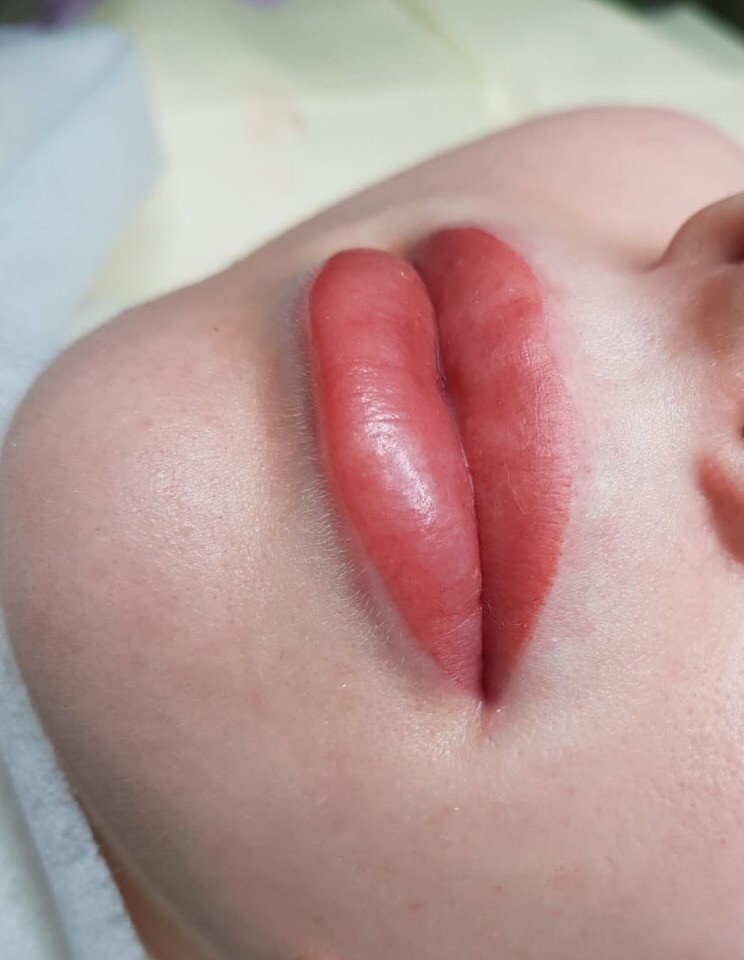 Trucco Permanente delle labbra (subbito dopo trattamento)