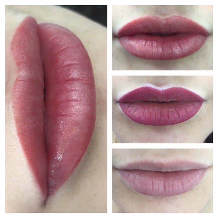Trucco Permanente delle labbra (subbito dopo trattamento)