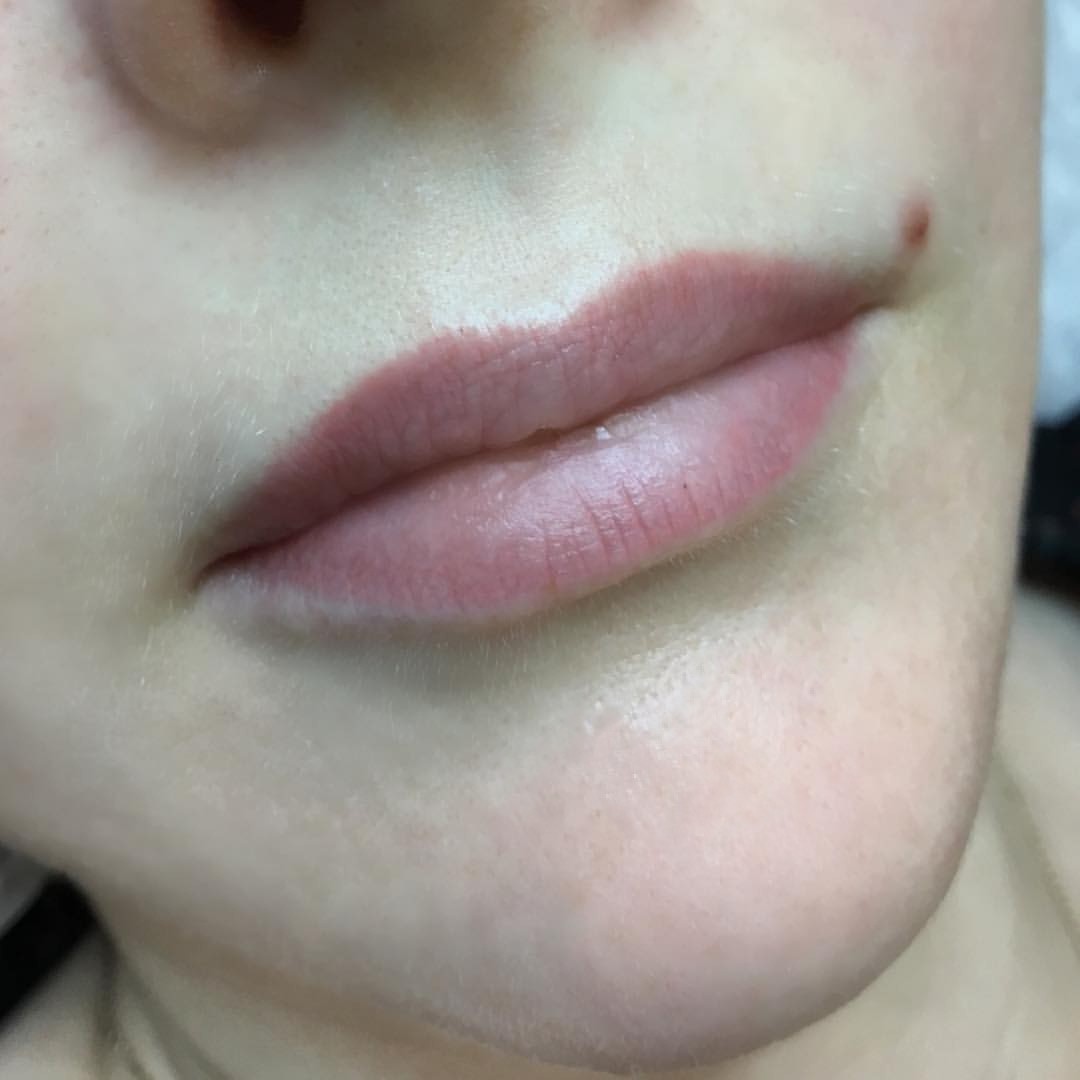 Trucco Permanente delle labbra (guarito)