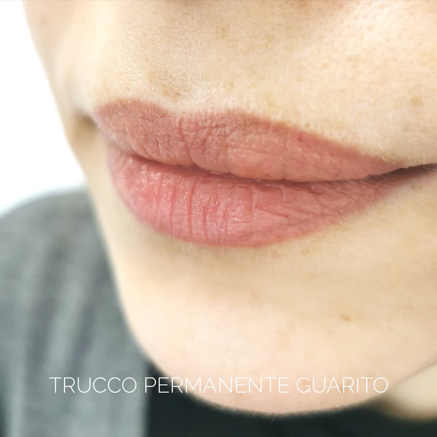 Trucco Permanente delle labbra (guarito)